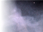 thumbnail 148*82