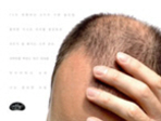 thumbnail 148*82