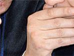 thumbnail 148*82